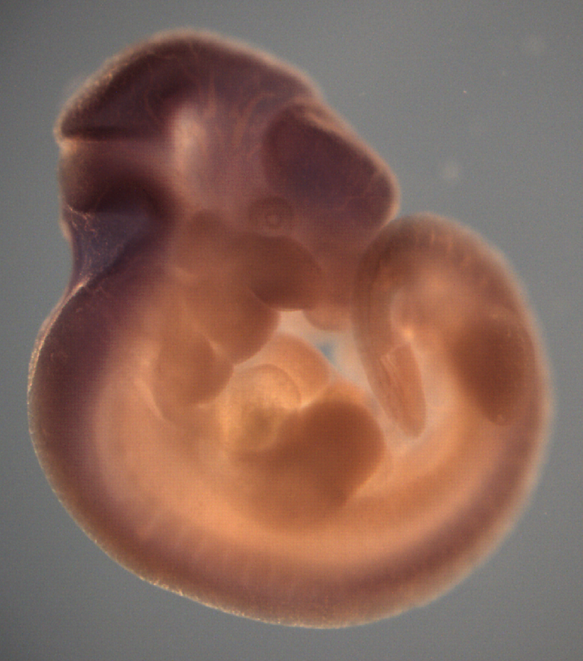 photo of a theiler stage 19 mouse embryo in situ hybridized with a frizzled 3 probe
