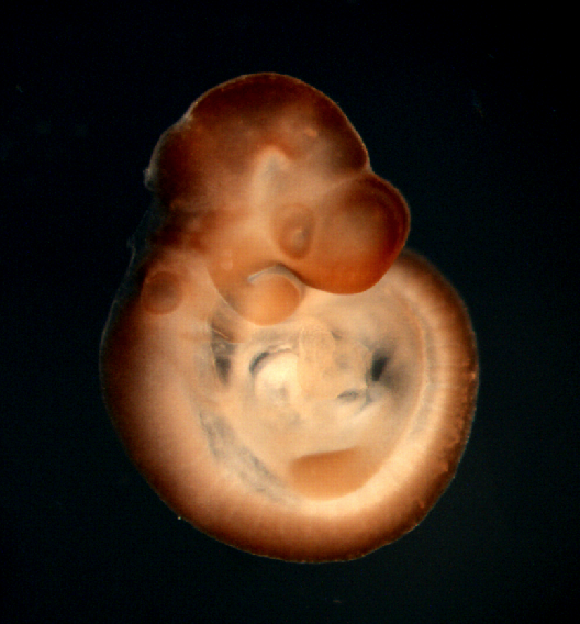 photo of a theiler stage 15 mouse embryo in situ hybridized with a frizzled 3 probe
