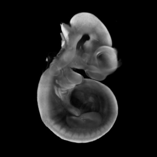 3D computer representation of a theiler stage 17 mouse embryo in situ hybridized with a frizzled 3 probe