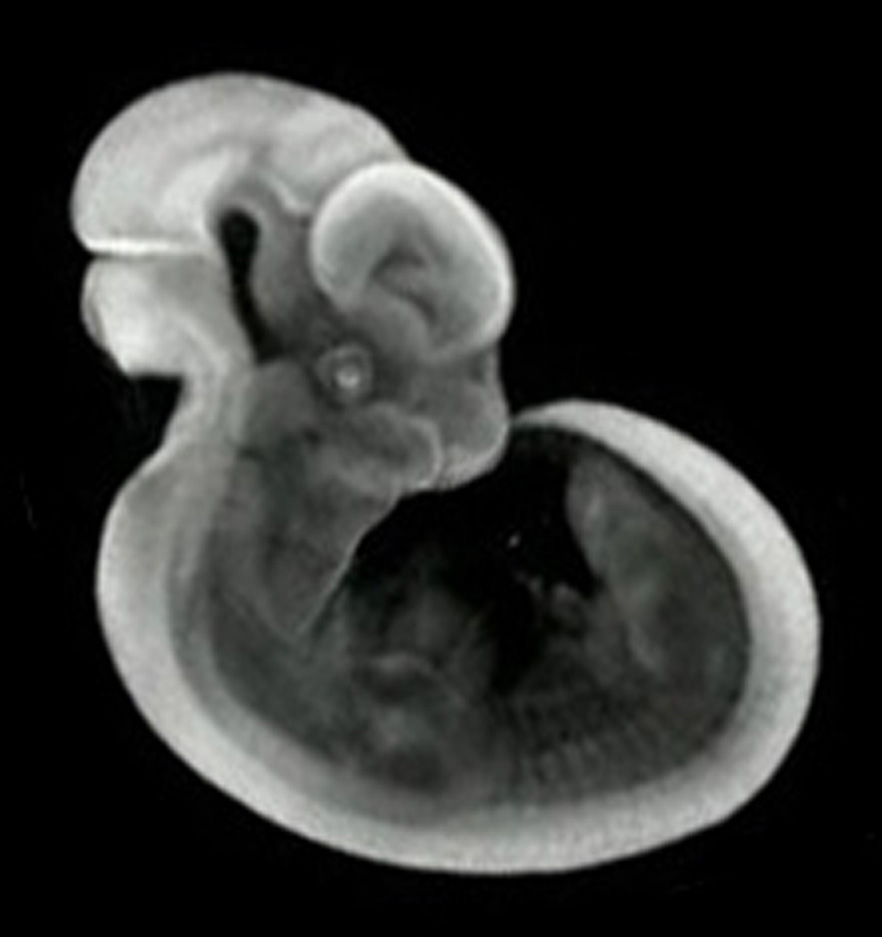 3D computer representation of a theiler stage 19 mouse embryo in situ hybridized with a frizzled 3 probe