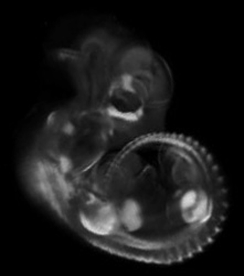 3d computer reconstruction of a mouse embryo in situ hybridized with a wnt 11 probe
