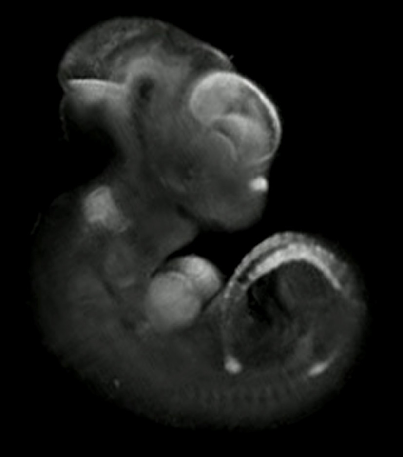 3D computer representation of a theiler stage 19 mouse embryo in situ hybridized with a wnt 16 probe