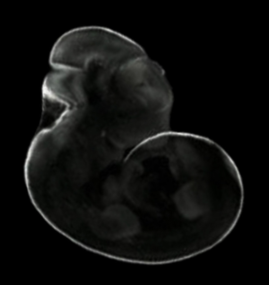3D computer representation of a theiler stage 19 mouse embryo in situ hybridized with a wnt1 probe