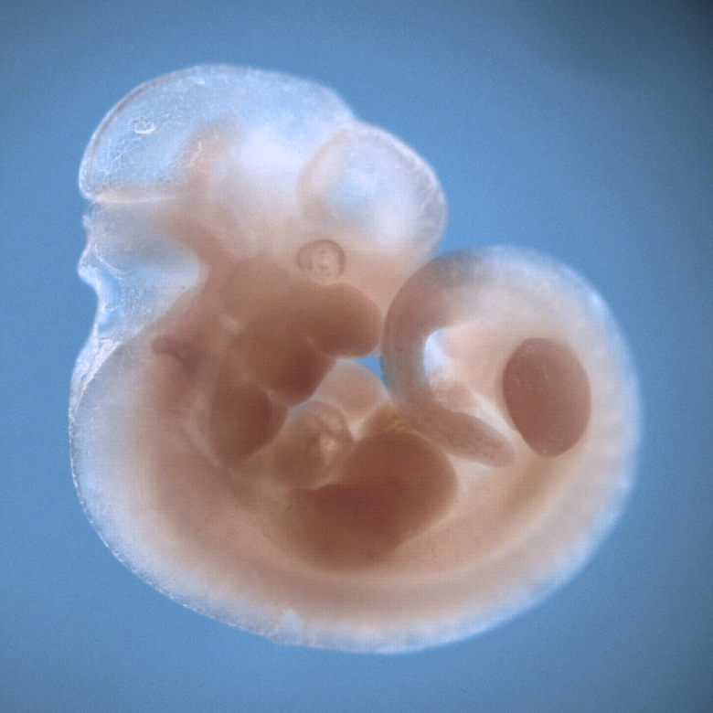 photo of a theiler stage 19 mouse embryo in situ hybridized with a wnt 2b probe