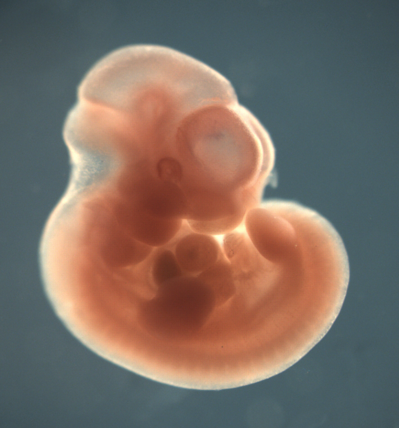 photo of a theiler stage 17 mouse embryo in situ hybridized with a wnt 2b probe