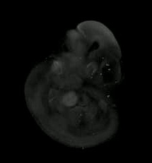 3D computer representation of a theiler stage 17 mouse embryo in situ hybridized with a wnt 2b probe