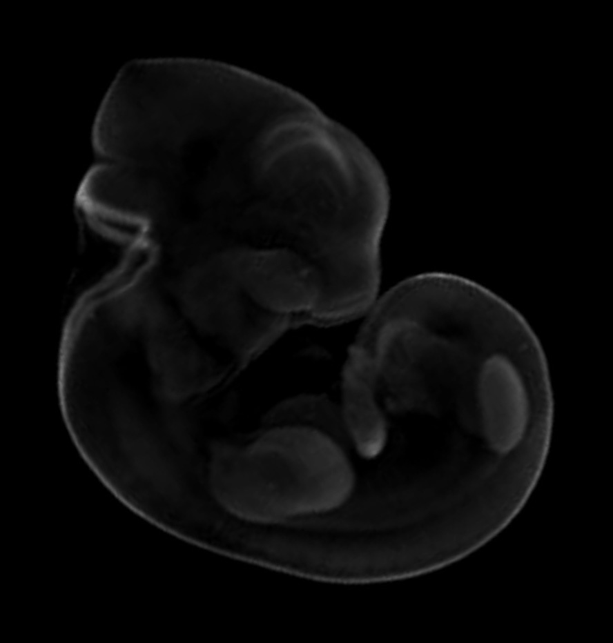3D representation of the Wnt 3A expression pattern in a theiler stage 19 mouse embryo