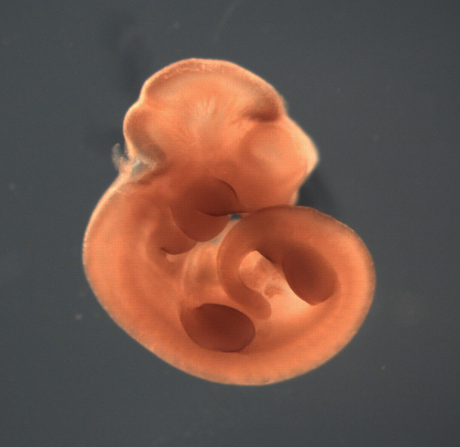 photo of a theiler stage 17 mouse embryo in situ hybridized with a wnt 3 probe