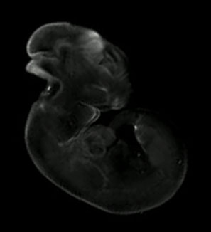 3D computer representation of a theiler stage 19 mouse embryo in situ hybridized with a wnt 3 probe