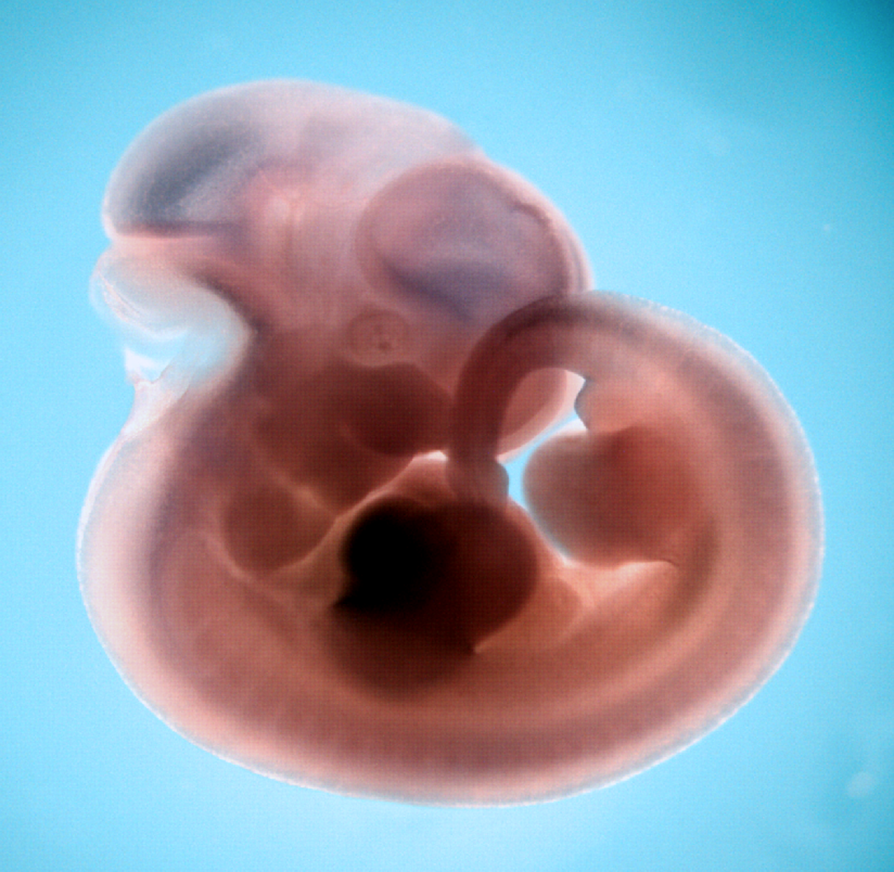 photo of a theiler stage 19 mouse embryo in situ hybridized with a wnt 7a probe