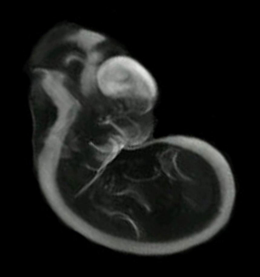 3D computer representation of a theiler stage 19 mouse embryo in situ hybridized with a wnt 7b probe