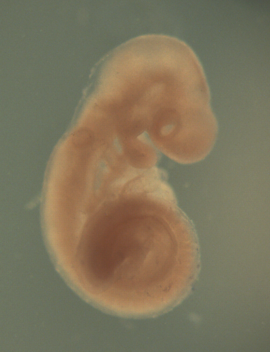 photo of a theiler stage 15 mouse embryo in situ hybridized with a wnt 2b probe