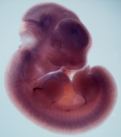 photo of a theiler stage 19 mouse embryo in situ hybridized with a frizzled 6 probe