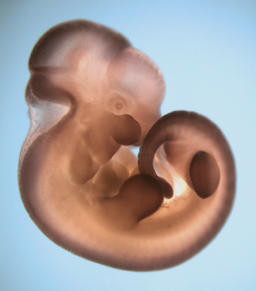 photo of a theiler stage 19 mouse embryo in situ hybridized with a frizzled 10 probe