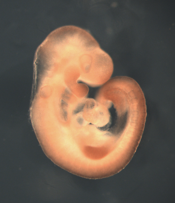 photo of a theiler stage 15 mouse embryo in situ hybridized with a frizzled 10 probe