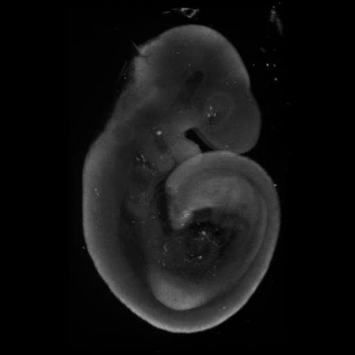 3D computer representation of a theiler stage 15 mouse embryo in situ hybridized with a frizzled 10 probe