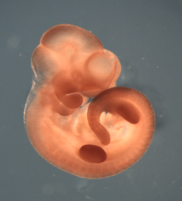 photo of a theiler stage 17 mouse embryo in situ hybridized with a frizzled 10 probe
