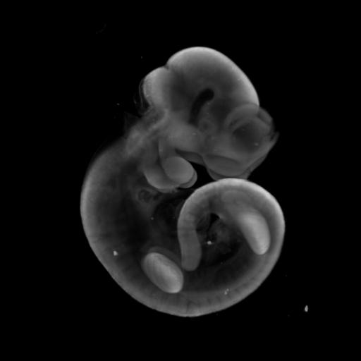3D computer representation of a theiler stage 17 mouse embryo in situ hybridized with a frizzled 10 probe