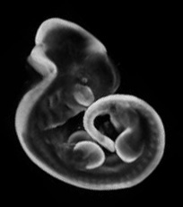 3D computer representation of a theiler stage 19 mouse embryo in situ hybridized with a frizzled 10 probe