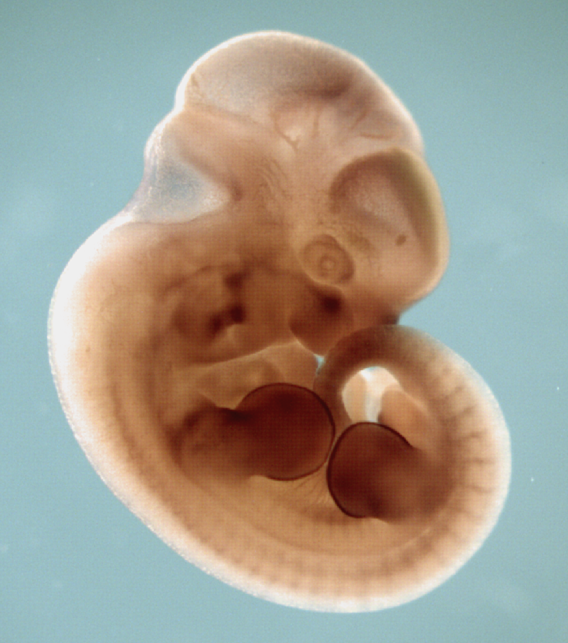 photo of a theiler stage 19 mouse embryo in situ hybridized with a frizzled 1 probe