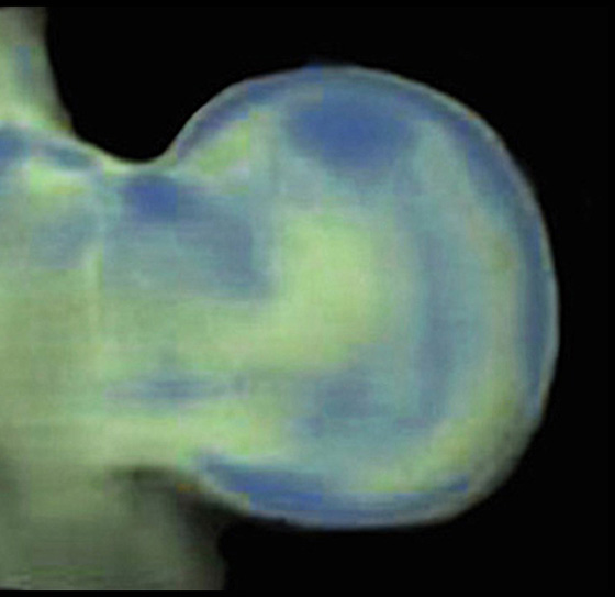 3D computer representation of a theiler stage 19 mouse forelimb in situ hybridized with a frizzled 1 probe
