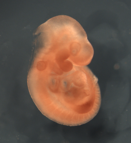 photo of a theiler stage 15 mouse embryo in situ hybridized with a frizzled 1 probe