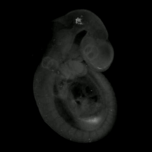 3D computer representation of a theiler stage 15 mouse embryo in situ hybridized with a frizzled 1 probe