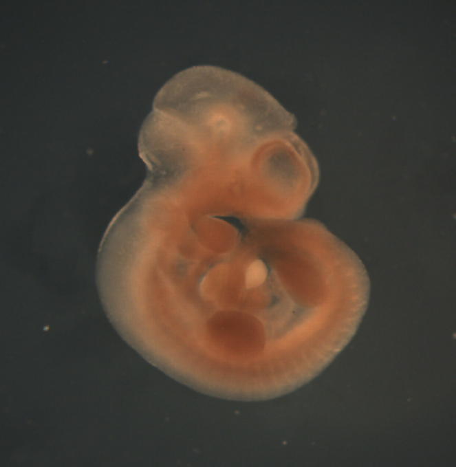 photo of a theiler stage 17 mouse embryo in situ hybridized with a frizzled 1 probe