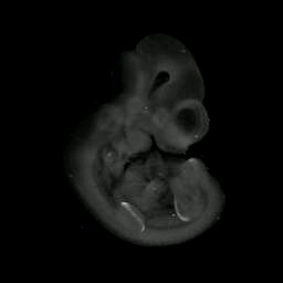 3D computer representation of a theiler stage 17 mouse embryo in situ hybridized with a frizzled 1 probe