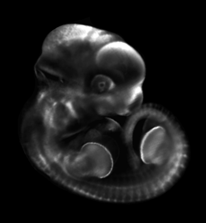 3D computer reconstruction of a thieler stage 19 mouse embryo in situ hybridized with a frizzled 1 probe