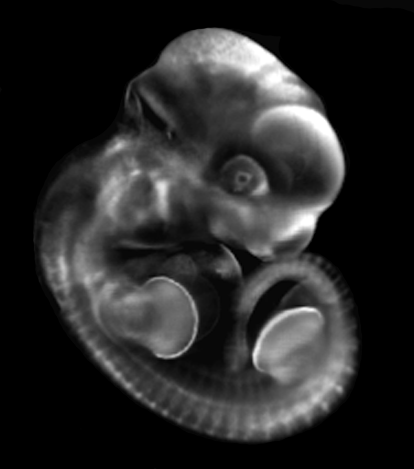 3D computer representation of a theiler stage 19 mouse embryo in situ hybridized with a frizzled 1 probe