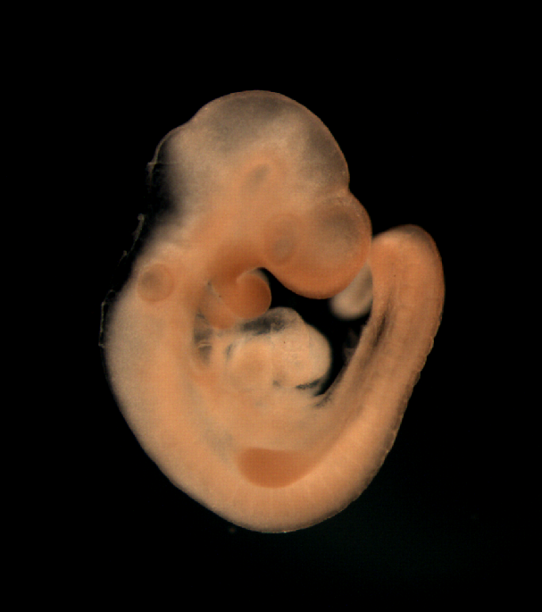 photo of a theiler stage 15 mouse embryo in situ hybridized with a frizzled 2 probe
