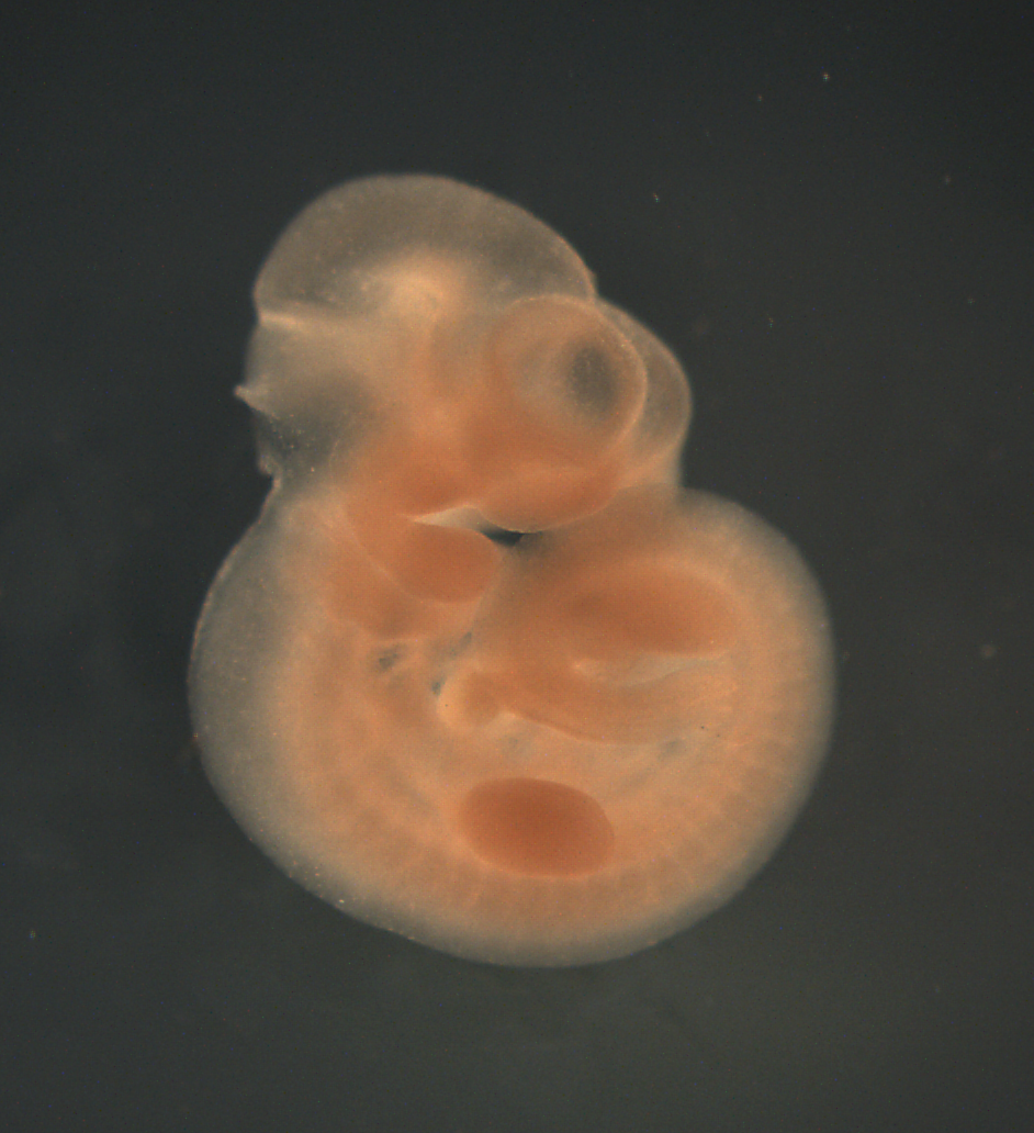 photo of a theiler stage 17 mouse embryo in situ hybridized with a frizzled 2 probe