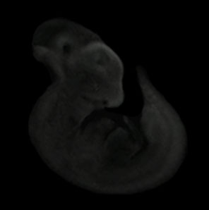 3D reconstruction of the Frizzled 2 gene expression pattern in the theiler stage 19 mouse embryo
