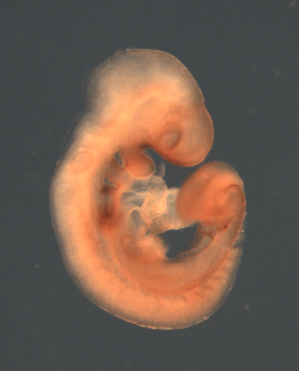 photo of a theiler stage 15 mouse embryo in situ hybridized with a frizzled 4 probe