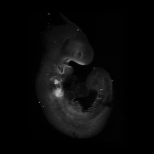 3D computer representation of a theiler stage 15 mouse embryo in situ hybridized with a frizzled 4 probe