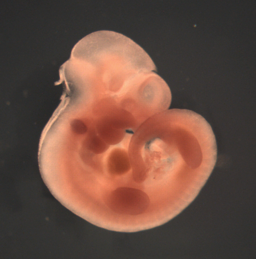 photo of a theiler stage 17 mouse embryo in situ hybridized with a frizzled 4 probe