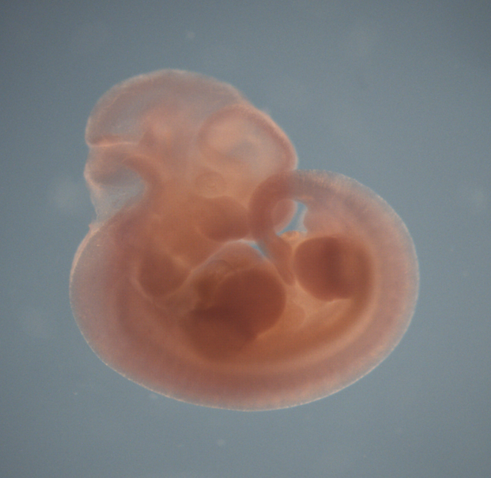 photo of a theiler stage 19 mouse embryo in situ hybridized with a frizzled 5 probe