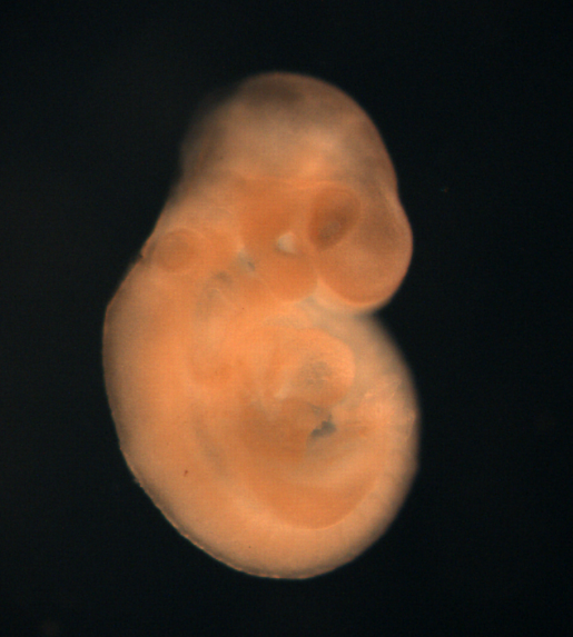 photo of a theiler stage 15 mouse embryo in situ hybridized with a frizzled 5 probe