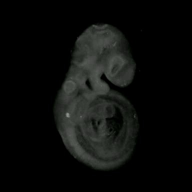 3D computer representation of a theiler stage 15 mouse embryo in situ hybridized with a frizzled 5 probe