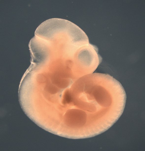 photo of a theiler stage 17 mouse embryo in situ hybridized with a frizzled 5 probe