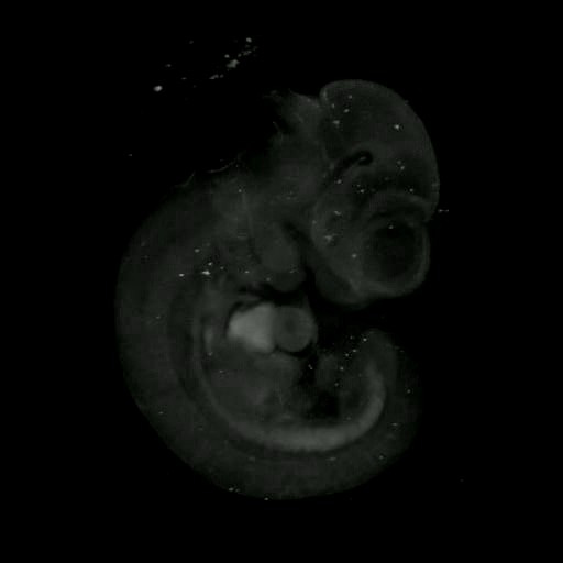 3D computer representation of a theiler stage 17 mouse embryo in situ hybridized with a frizzled 5 probe