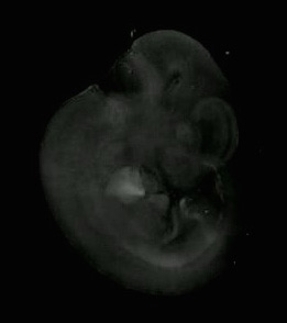 3D computer representation of a theiler stage 19 mouse embryo in situ hybridized with a frizzled 5 probe