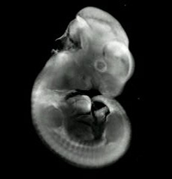 3D computer representation of a theiler stage 19 mouse embryo in situ hybridized with a frizzled 6 probe