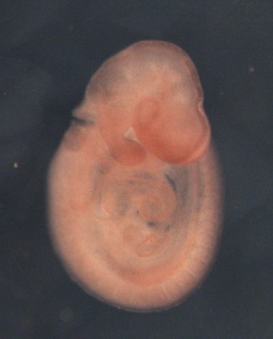 photo of a theiler stage 15 mouse embryo in situ hybridized with a frizzled 6 probe