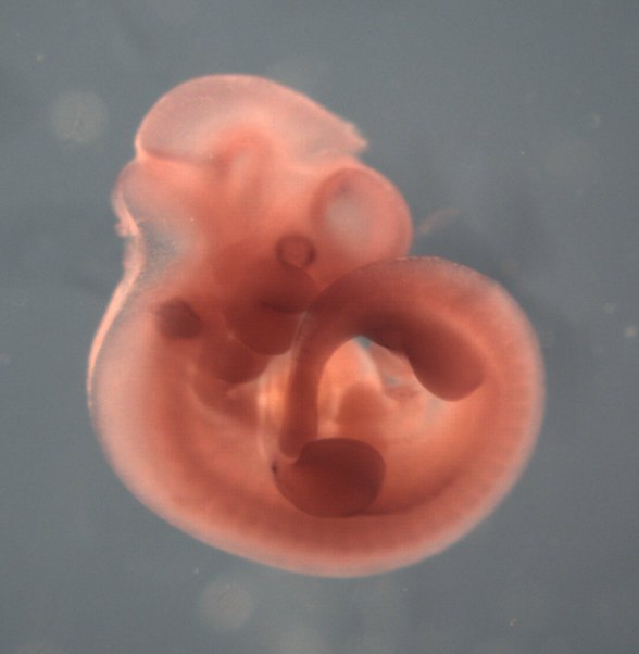 photo of a theiler stage 17 mouse embryo in situ hybridized with a frizzled 6 probe