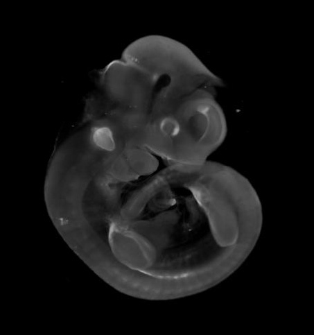 3D computer representation of a theiler stage 17 mouse embryo in situ hybridized with a frizzled 6 probe