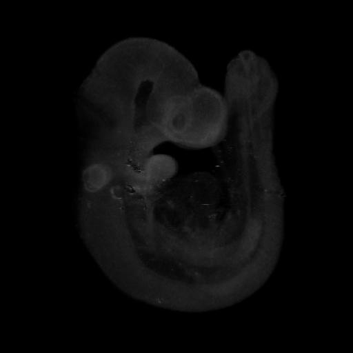 3D computer representation of a theiler stage 15 mouse embryo in situ hybridized with a frizzled 6 probe