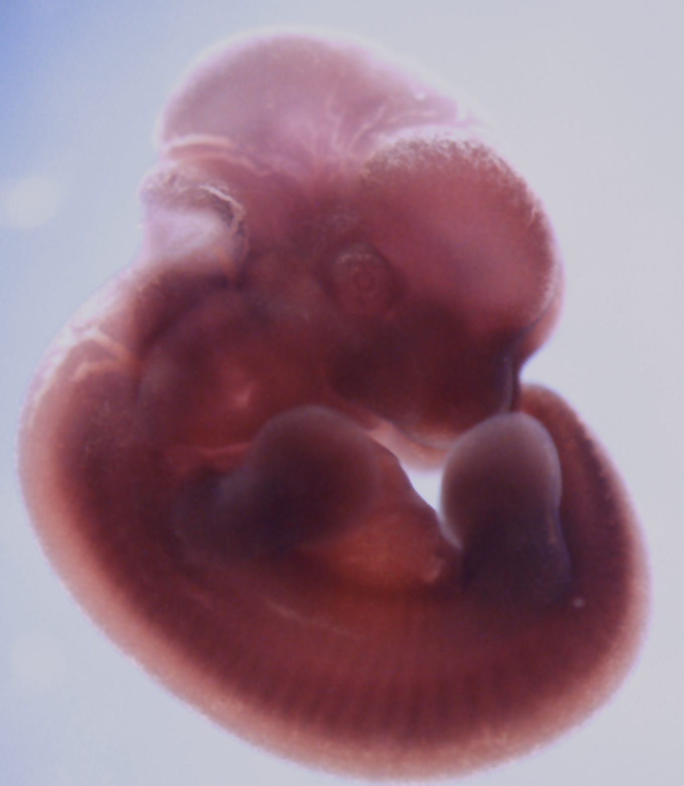 photo of a theiler stage 19 mouse embryo in situ hybridized with a frizzled 7 probe
