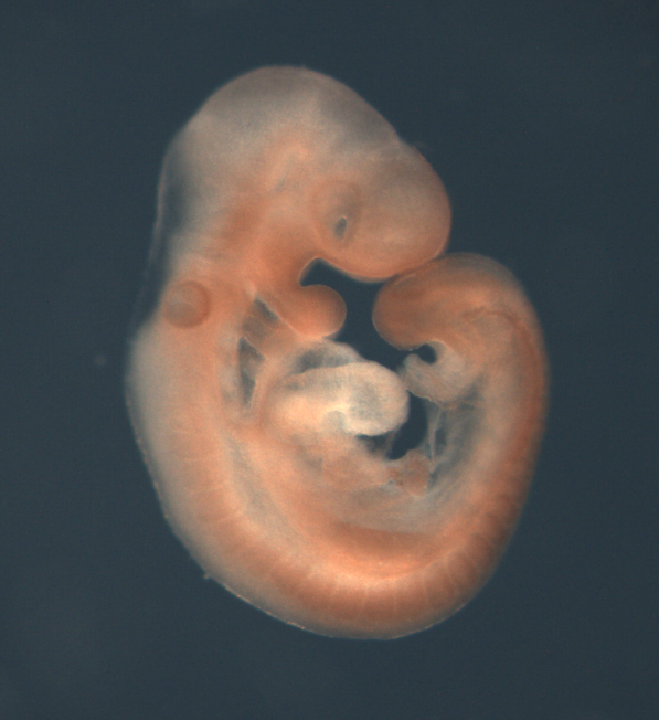 photo of a theiler stage 15 mouse embryo in situ hybridized with a frizzled 7 probe